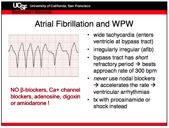Arrhythmias Wpw Syndrome Heart Attack Ventricular Fibrillation Images